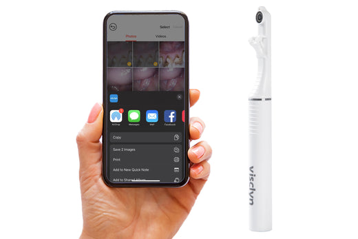 visclyn Smart Intraoral Camera